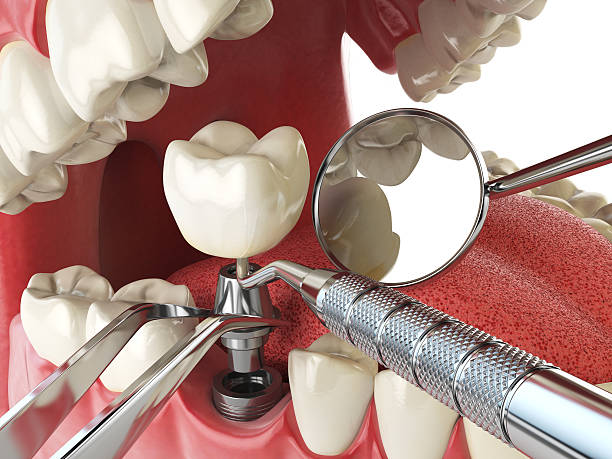 Best Emergency Treatment for Dental Infections or Abscesses in Sheboygan Falls, WI